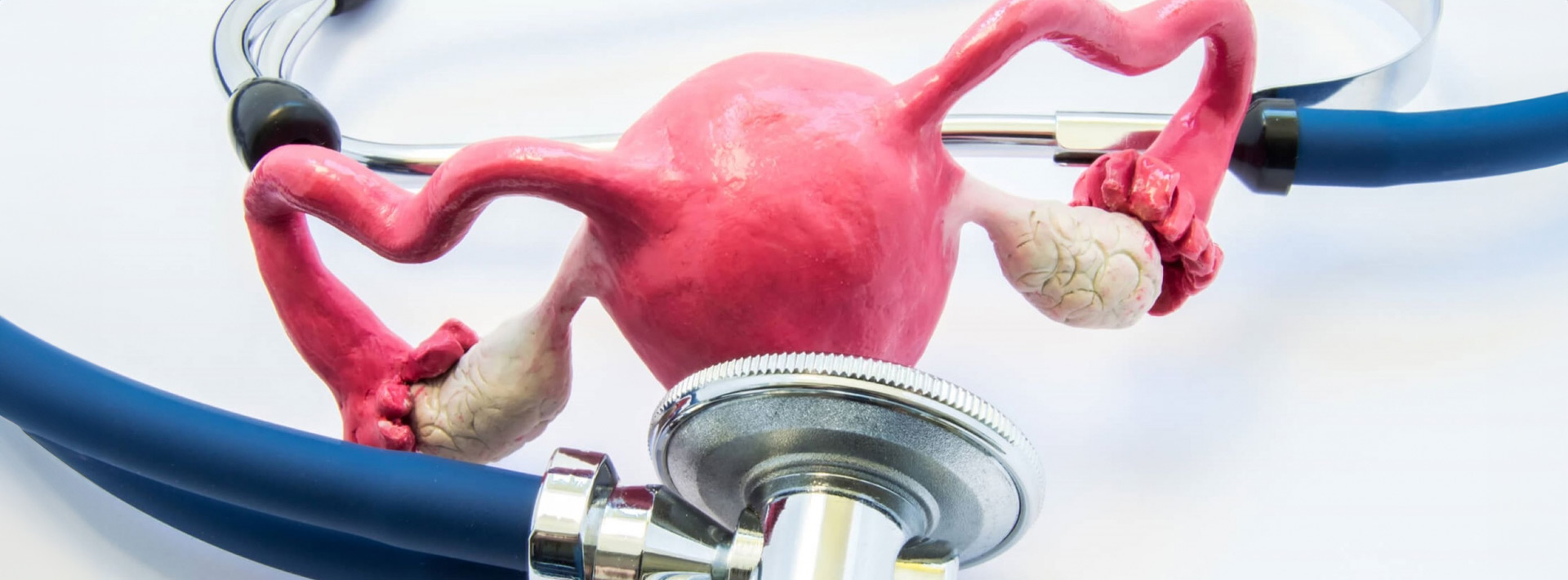 Ινομυώματα