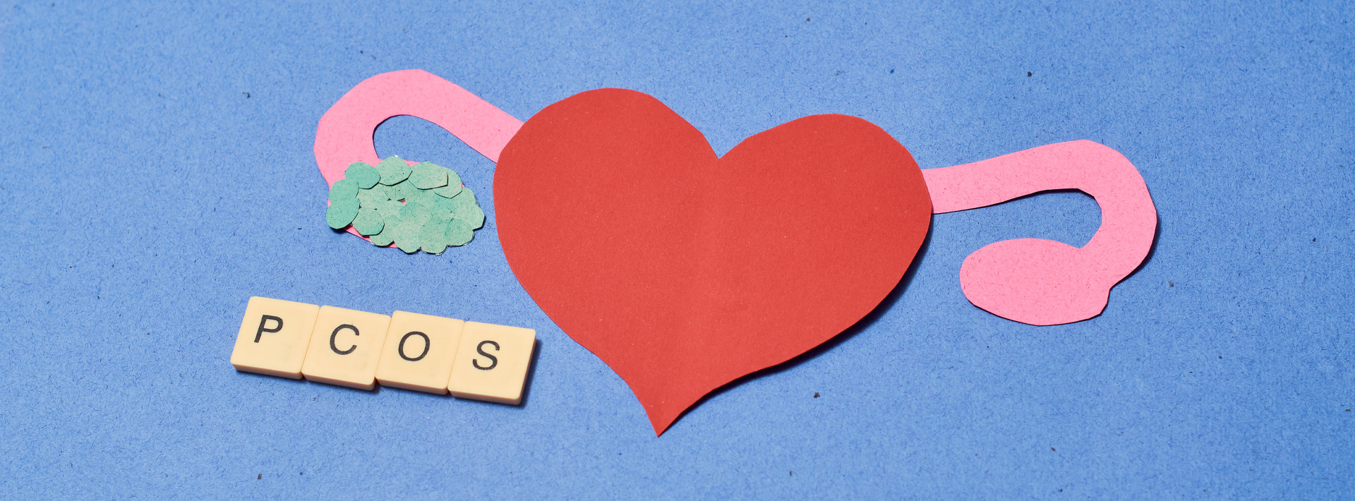 Σύνδρομο Πολυκυστικών Ωοθηκών