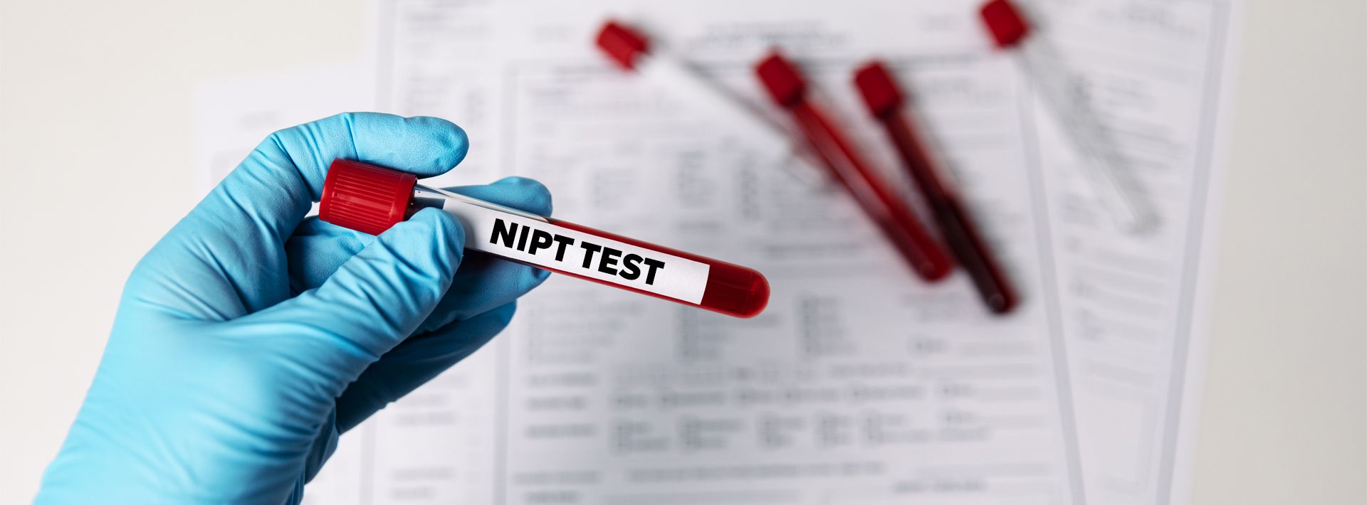 Μη επεμβατικός προγεννητικός έλεγχος (NIPT)